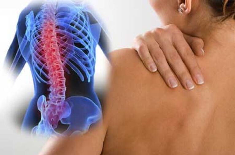 Κατά τη διάρκεια μιας έξαρσης της οστεοχονδρωσίας της θωρακικής σπονδυλικής στήλης, εμφανίζεται ραχιαίος πόνος